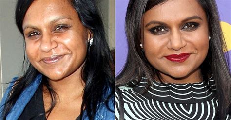 mindy kaling plastic surgery|Mindy Kaling’s Plastic Surgery: The 43